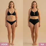 Sirena | Korrekciós Bikini